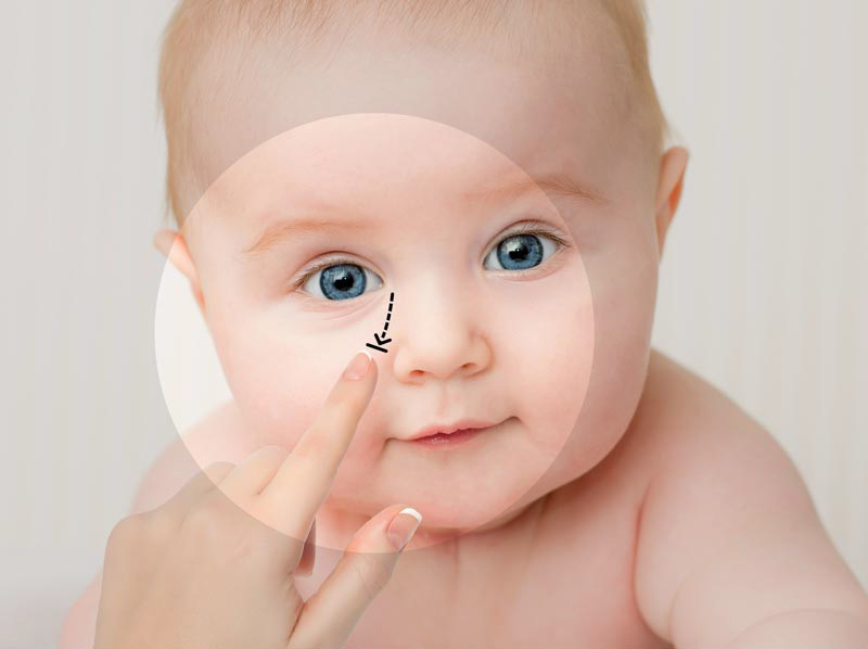 Baby Blocked Tear Duct Choice Pharmacy